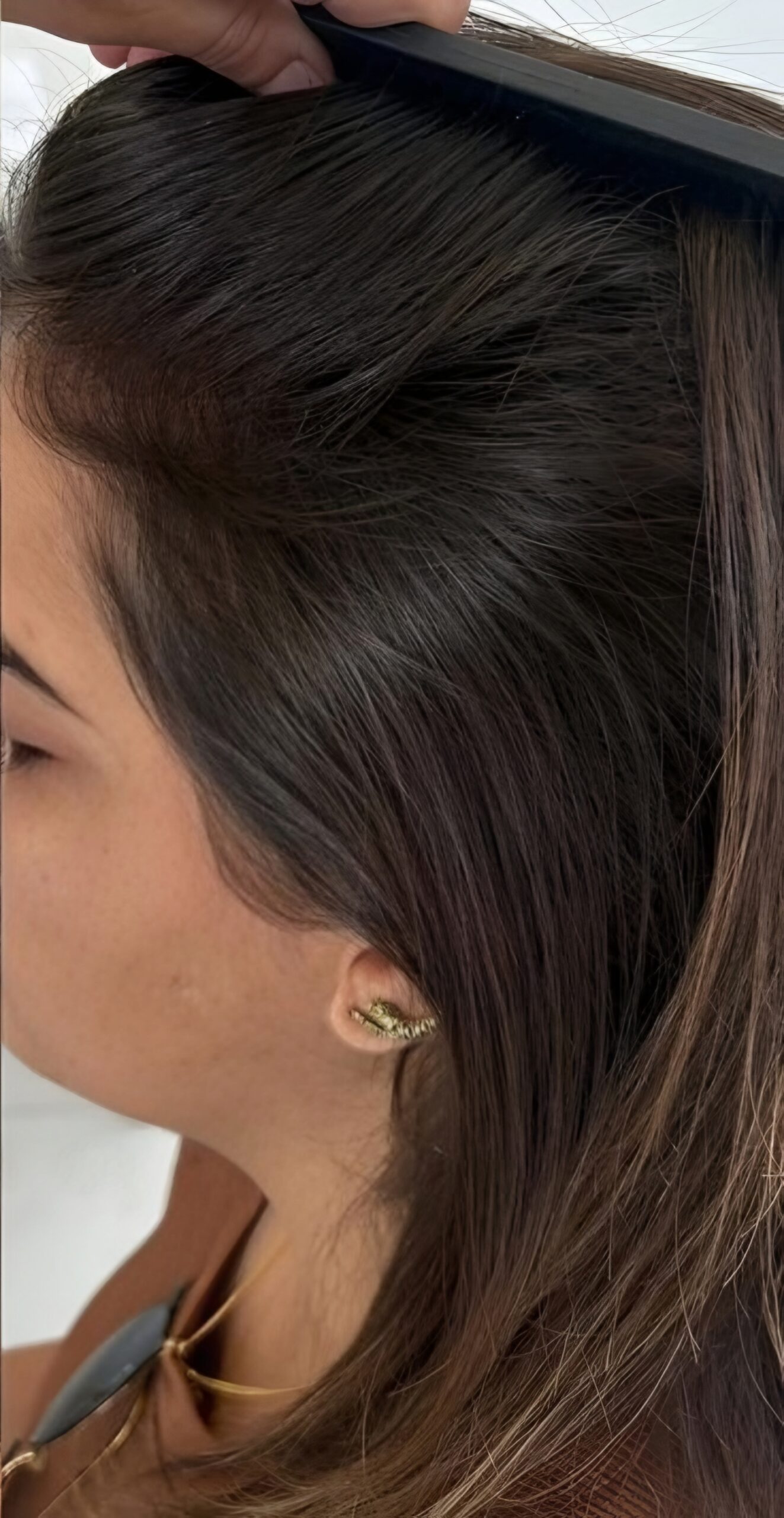 تحسن مظهر خط الشعر بعد استخدام سيروم DENSYA